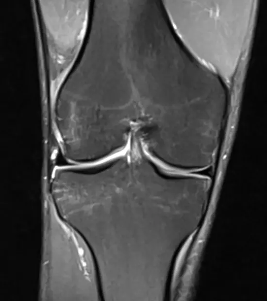 Normal knee bone blood supply