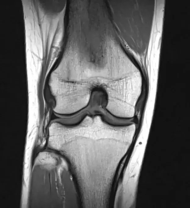 Normal knee